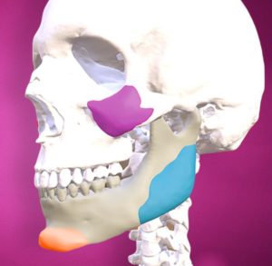 Aesthetic Skull Reshaping