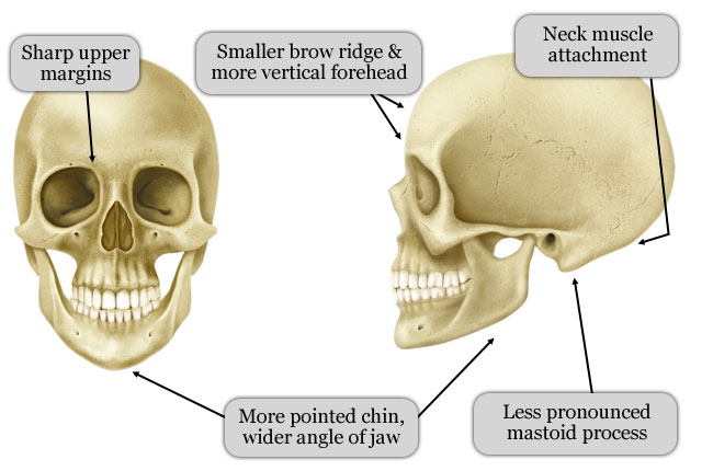 Female Skull Facial Feminization Surgery